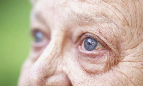Виды, стадии и симптомы возрастной катаракты