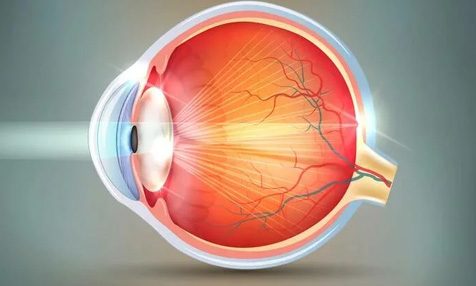 Удаление катаракты глаза ультразвуком