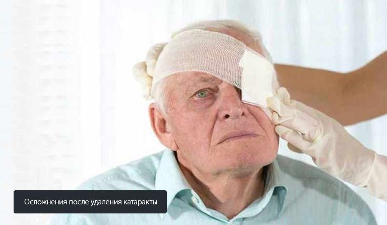 Осложнения после операции катаракты