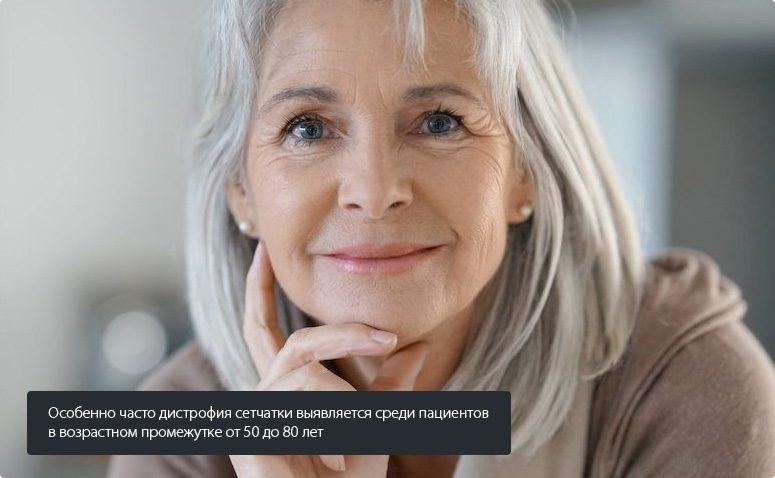 Особенно часто дистрофия сетчатки выявляется среди пациентов  в возрастном промежутке от 50 до 80 лет
